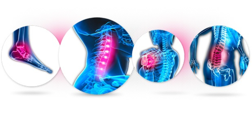 Fisioterapia